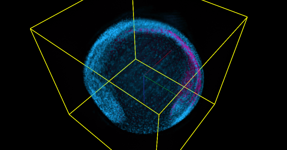 Zebrafish embryo imaged with a OpenSiMView microscope