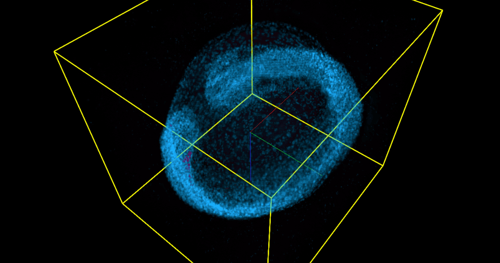 Zebrafish embryo imaged with a OpenSiMView microscope
