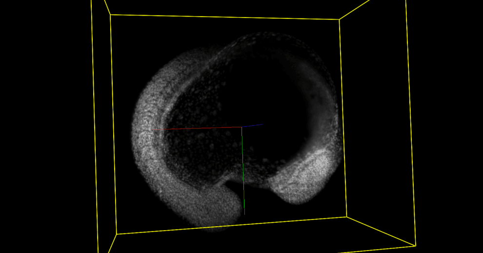 Zebrafish embryo imaged with DaXi light-sheet microscope