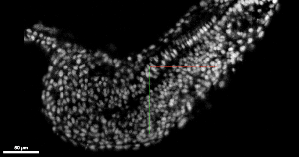 Zebrafish embryo imaged with DaXi light-sheet microscope. Zoom in on tail.